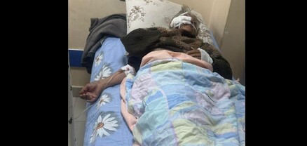 Գյումրիում շները հարձակվել են 68-ամյա կնոջ վրա
