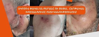Սկոտչով փակել են բերանը ու ծեծել․ հերթական խոշտանգումը՝ ոստիկանությունում․ ՈՒՂԻՂ