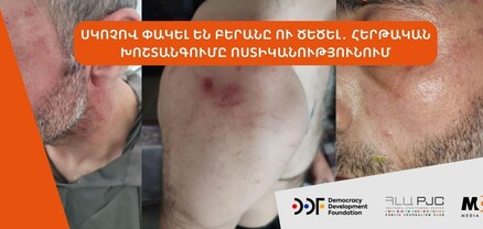 Սկոտչով փակել են բերանը ու ծեծել․ հերթական խոշտանգումը՝ ոստիկանությունում․ ՈՒՂԻՂ
