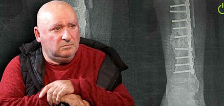 Կոտրված ոտքիս ոսկորները սխալմամբ հեռացրել են, դարձել եմ հաշմանդամ, առողջ ոտքիցս էլ ասեղ դուրս եկավ