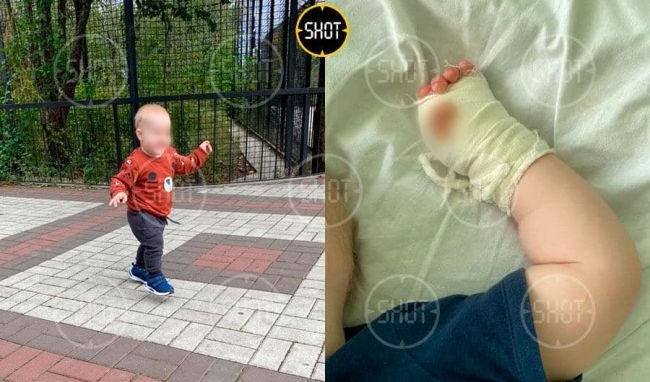 Ղրիմում վագրը պոկել է մեկամյա երեխայի մատը