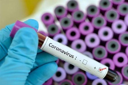 1054 նոր դեպք, 37 մահ` մեկ օրում. կորոնավիրուսային հիվանդության ընթացքը Հայաստանում