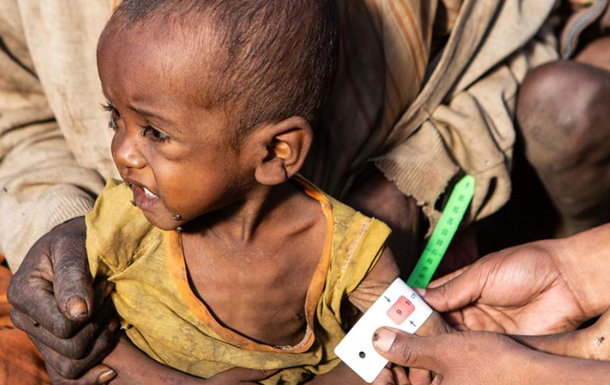 ՄԱԿ-ը հայտարարել է Մադագասկարում սովի մասին
