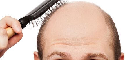 Ճաղատ մարդկանց մազերի փոխպատվաստումը սկսել են փորձարկել մկների վրա