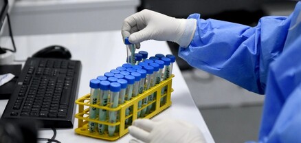 Վրաստանում հայտնաբերվել է կորոնավիրուսի ավելի քան 24 հազար նոր դեպք