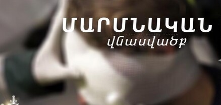 Վիճաբանության ժամանակ մարմնական վնասվածքներ էր պատճառել համաքաղաքացուն