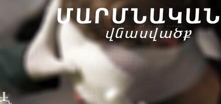 Նախկին կնոջ այժմյան ընկերը մետաղյա խողովակով հարվածել է ընկերուհու նախկին ամուսնուն․ մանրամասներ միջադեպից