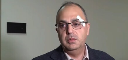 Պատգամավորների միջև միջադեպի հետքերով. տուժողը նիստի չի գնացել. Ժողովուրդ