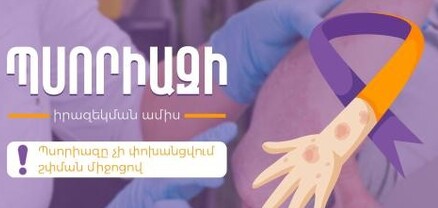 Կարող է լուրջ ազդեցություն ունենալ կյանքի որակի վրա․ օգոստոսը Պսորիազի իրազեկման ամիս է
