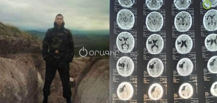 «Մուրացանի» հոսպիտալում բժիշկը հանել է օրգաններս․ այս երկրում գերու կարգավիճակ ունեմ․ նախկին զինծառայող