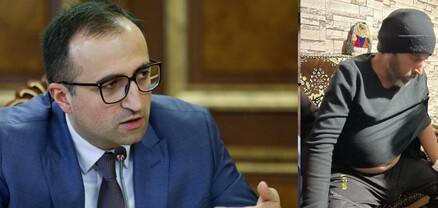 Կապի մեջ ենք Օհանի հարազատների հետ, կփորձենք աջակցել բուժման իրականացմանը. Արսեն Թորոսյան