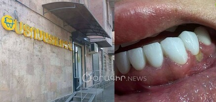 «Դոկտոր Ավոյան»-ում բուժառուի ատամնաշարը սխալ են բուժել և լնդերը վնասել են