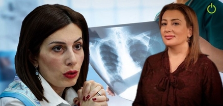 Պետությունը նորից մտնում է ուսուցիչների գրպանը․ ֆլյուրոգրաֆիան ապահովագրության մեջ չի մտնում
