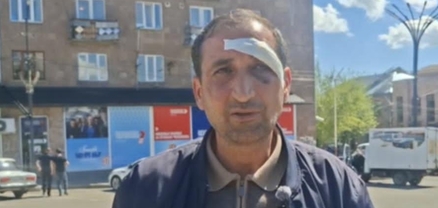 ՔՊ-ականների կողմից Արթիկում ծեծված քաղաքացին բողոքը հետ է վերցրել, պնդում է, որ այլևս բողոք չունի