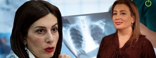 Պետությունը նորից մտնում է ուսուցիչների գրպանը․ ֆլյուրոգրաֆիան ապահովագրության մեջ չի մտնում