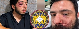 «Եթե օրենք էին խախտել, պետք էր բաժին տանել, ոչ թե ծեծել»․ նոր մանրամասներ՝ պարեկների և քաղաքացիների միջև ծեծկռտուքից